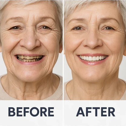 🔥🔥50% off on amazing smile products! Customizable functional dentures🦷