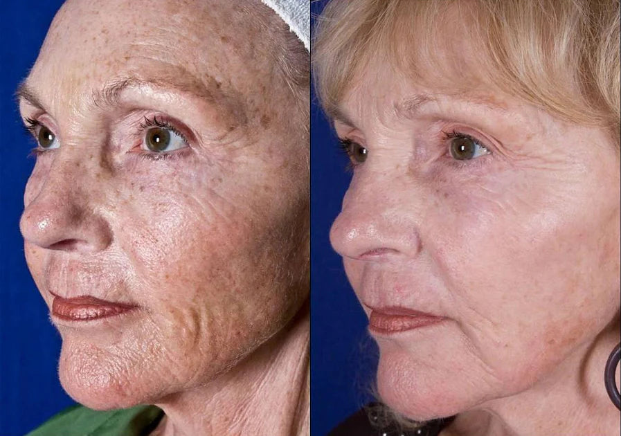 ⏰Last day 50% off🔥🔥 Bee Venom Anti-Wrinkle Cream🐝 Brightens skin and reduces wrinkles💡