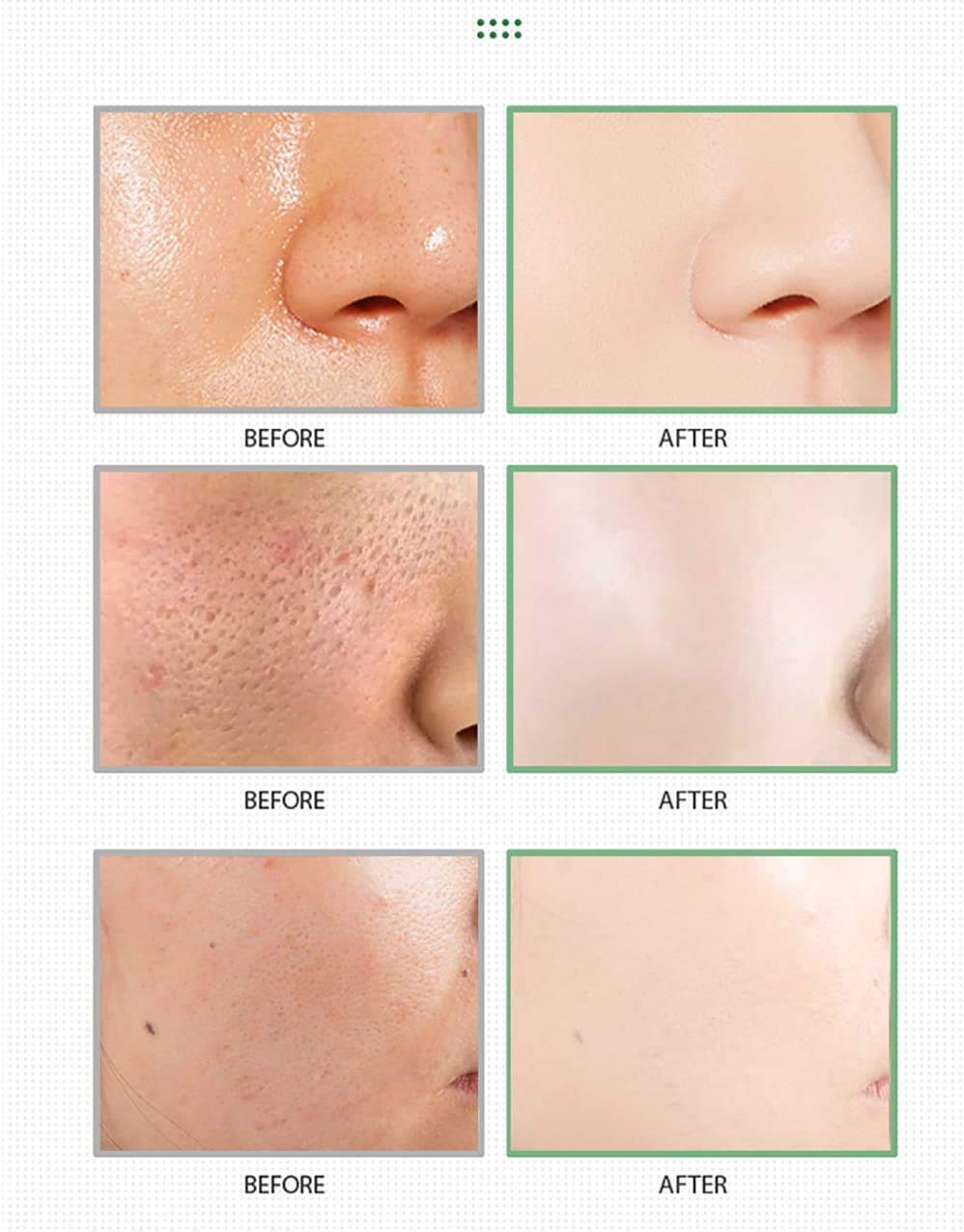 🔥50% off green tea sticks! 🔥Pore cleaner, blackheads gone in seconds🍓