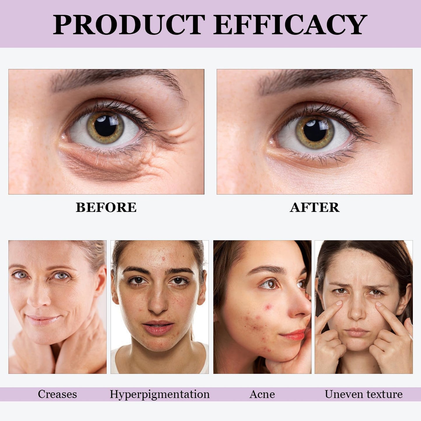 🔥🔥50% off Bakuchiol Serum! 🌿Reduce lines and pores, and your face will be so smooth that the filter will be off💧
