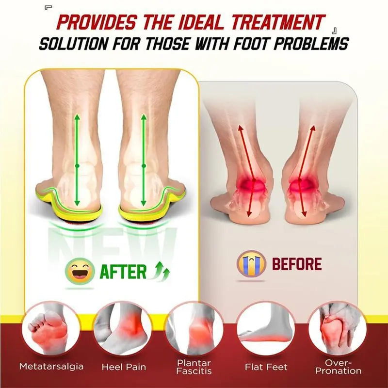 👟Specialized for sole pain! 🔥These insoles are 50% off🔥