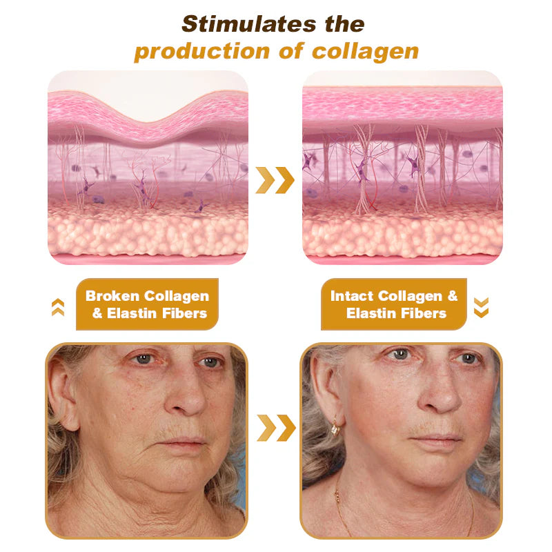 ⏰Last day 50% off🔥🔥 Bee Venom Anti-Wrinkle Cream🐝 Brightens skin and reduces wrinkles💡