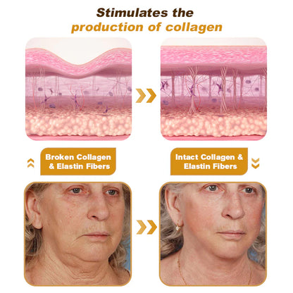 ⏰Last day 50% off🔥🔥 Bee Venom Anti-Wrinkle Cream🐝 Brightens skin and reduces wrinkles💡