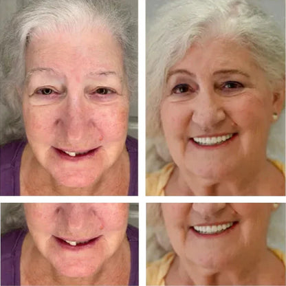 🔥🔥50% off on amazing smile products! Customizable functional dentures🦷