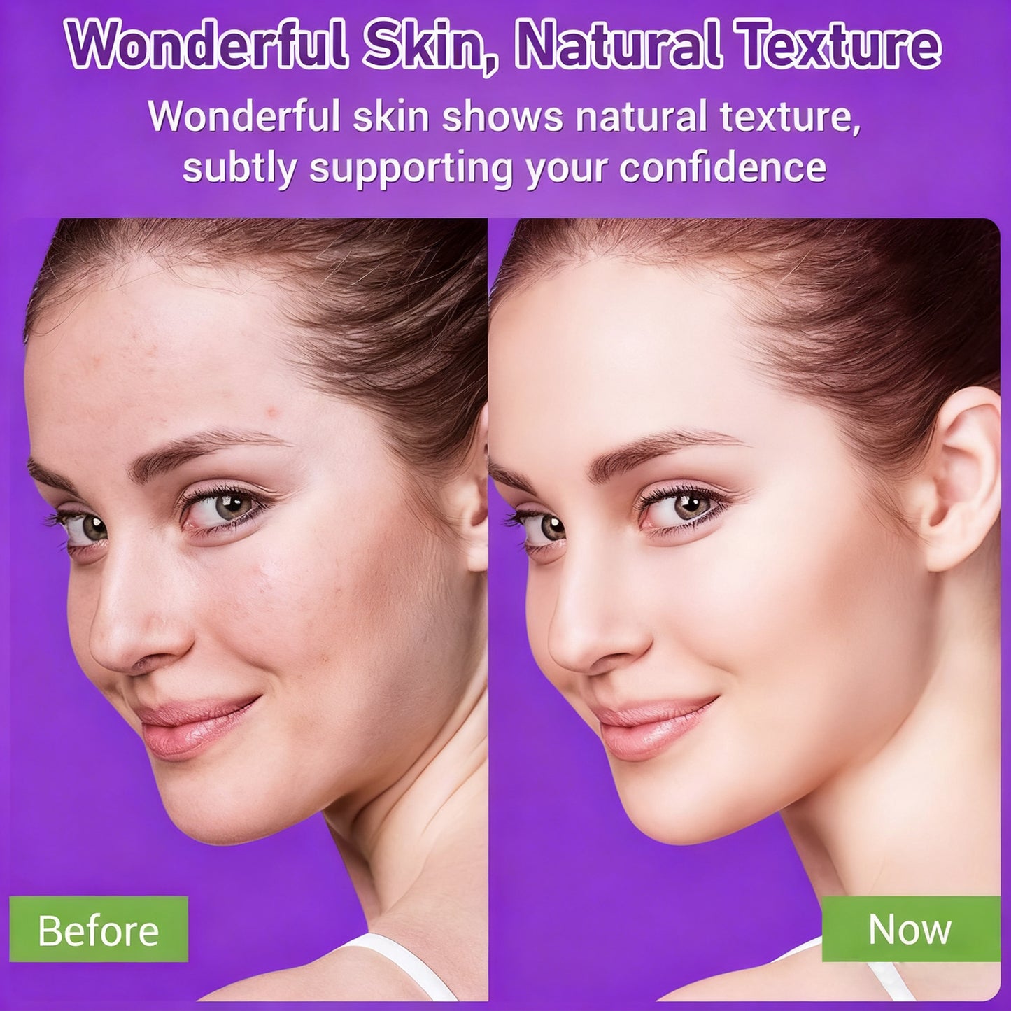 🔥🔥50% off microdermabrasion serum 💧 No redness on sensitive skin, no photorejuvenation