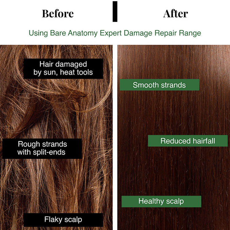 💇‍♀️Worried about baldness? 💧50% off Rosemary Hair Growth Oil to awaken your hair follicles! 🔥