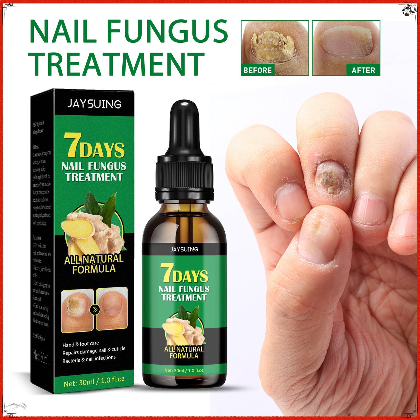🌿Natural ginger essence! 🔥50% off on antibacterial and nail-nourishing products! 🔥