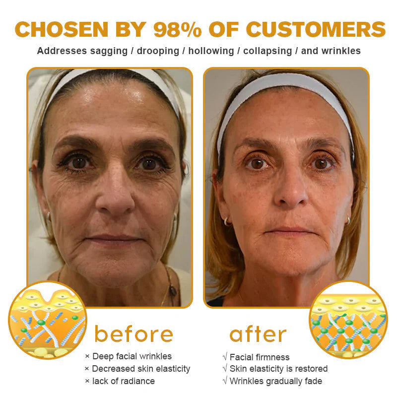 ⏰Last day 50% off🔥🔥 Bee Venom Anti-Wrinkle Cream🐝 Brightens skin and reduces wrinkles💡