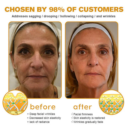 ⏰Last day 50% off🔥🔥 Bee Venom Anti-Wrinkle Cream🐝 Brightens skin and reduces wrinkles💡