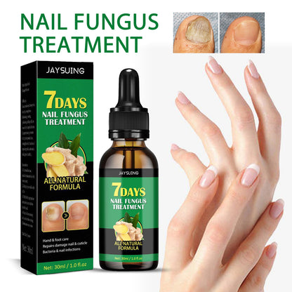 🌿Natural ginger essence! 🔥50% off on antibacterial and nail-nourishing products! 🔥