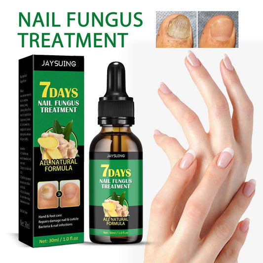 🌿Natural ginger essence! 🔥50% off on antibacterial and nail-nourishing products! 🔥