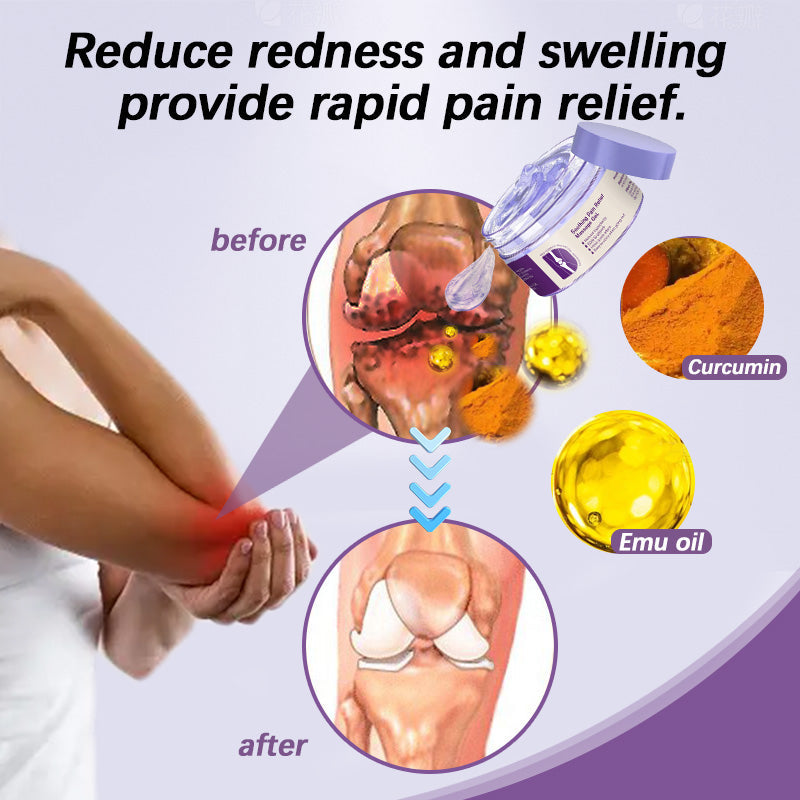 🔥🔥Ends Tonight: Get 50% OFF Before It’s Gone!🎁RINGMOY™ Pain Relief Gel – With Turmeric &amp; Emu Oil for Arthritis &amp; Joint Support