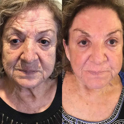 ⏰Last day 50% off🔥🔥 Bee Venom Anti-Wrinkle Cream🐝 Brightens skin and reduces wrinkles💡