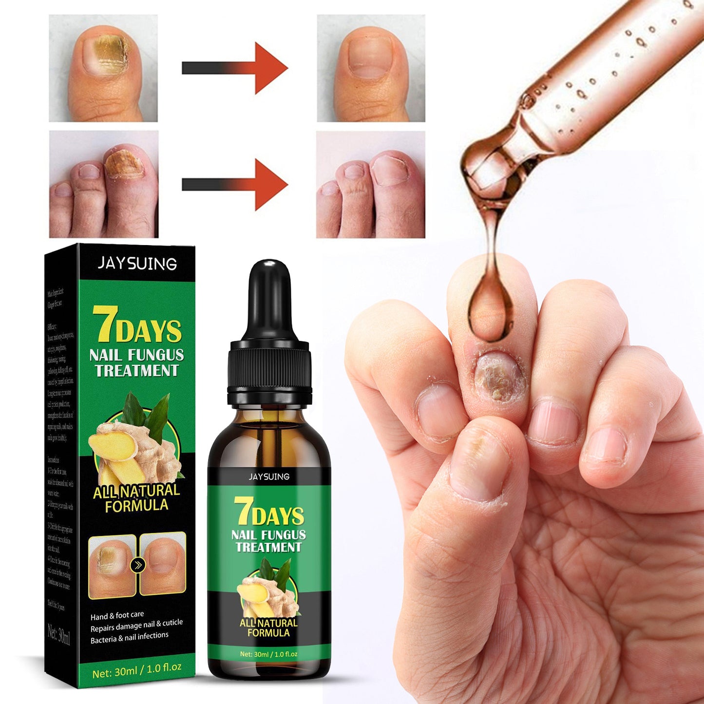 🌿Natural ginger essence! 🔥50% off on antibacterial and nail-nourishing products! 🔥