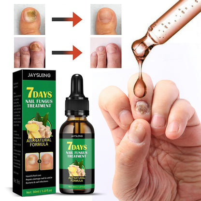 🌿Natural ginger essence! 🔥50% off on antibacterial and nail-nourishing products! 🔥