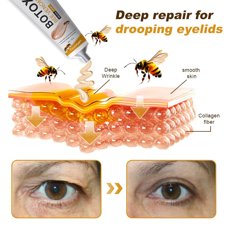 ⏰Last day 50% off🔥🔥 Bee Venom Anti-Wrinkle Cream🐝 Brightens skin and reduces wrinkles💡