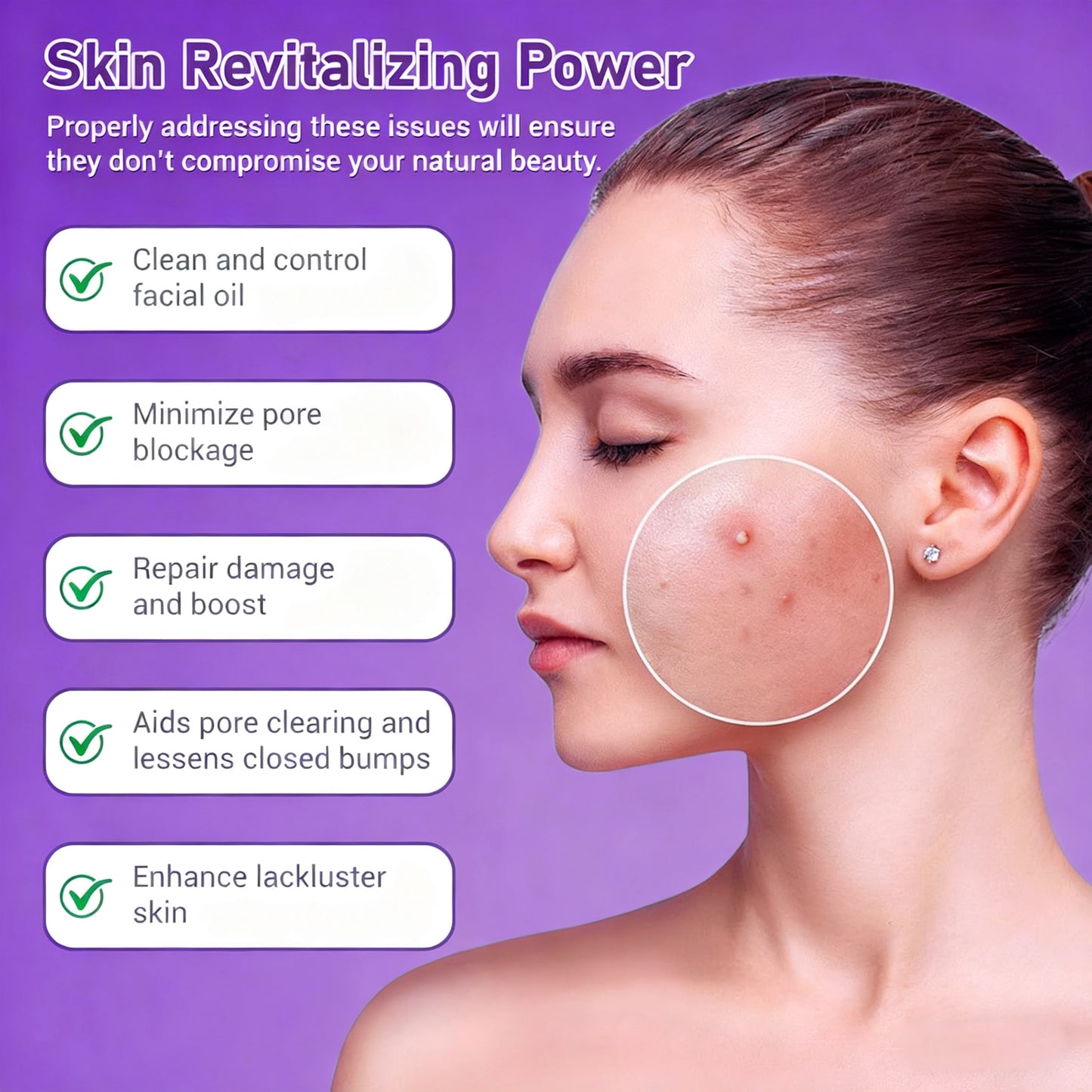 🔥🔥50% off microdermabrasion serum 💧 No redness on sensitive skin, no photorejuvenation