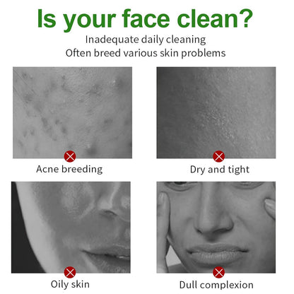 🔥50% off green tea sticks! 🔥Pore cleaner, blackheads gone in seconds🍓