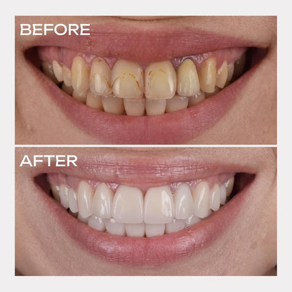 🔥🔥50% off! Purple Light Toothpaste whitens skin tone in 3 days ⚡