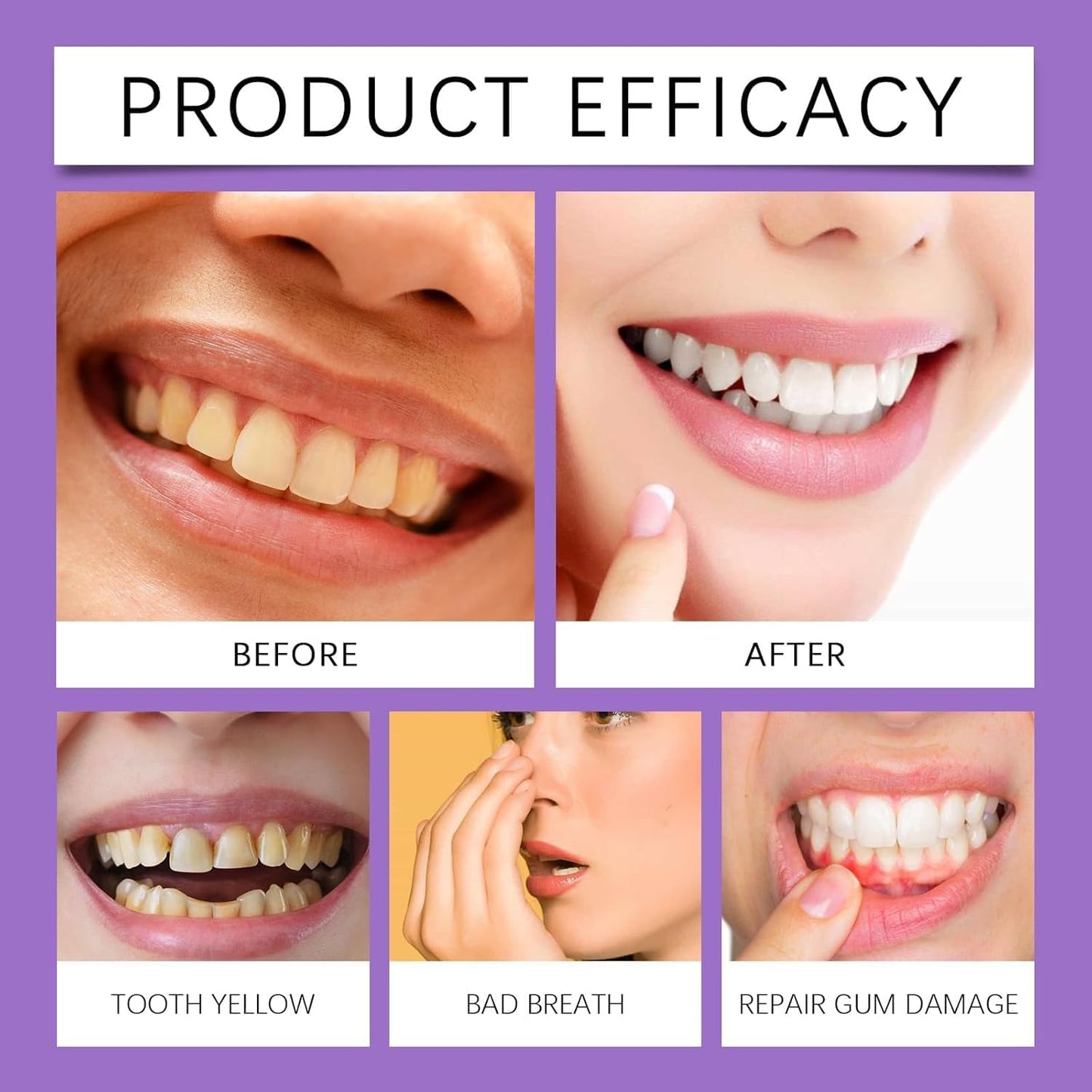 🔥🔥50% off! Purple Light Toothpaste whitens skin tone in 3 days ⚡