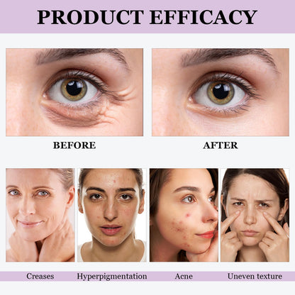 🔥🔥50% off Bakuchiol Serum! 🌿Reduce lines and pores, and your face will be so smooth that the filter will be off💧