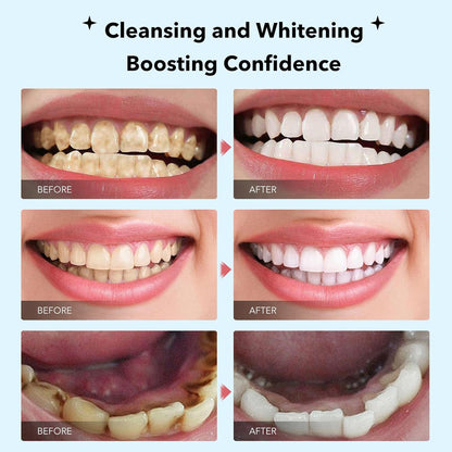 🔥🔥50% off! Purple Light Toothpaste whitens skin tone in 3 days ⚡