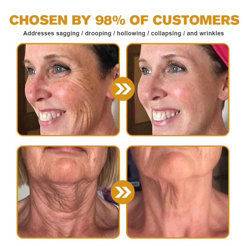 ⏰Last day 50% off🔥🔥 Bee Venom Anti-Wrinkle Cream🐝 Brightens skin and reduces wrinkles💡