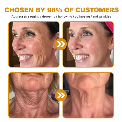 ⏰Last day 50% off🔥🔥 Bee Venom Anti-Wrinkle Cream🐝 Brightens skin and reduces wrinkles💡