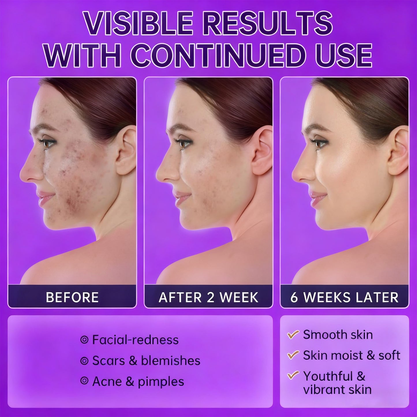 🔥🔥50% off microdermabrasion serum 💧 No redness on sensitive skin, no photorejuvenation