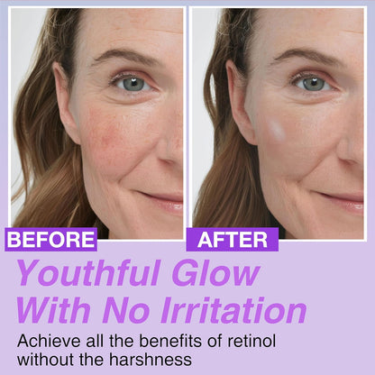 🔥🔥50% off Bakuchiol Serum! 🌿Reduce lines and pores, and your face will be so smooth that the filter will be off💧