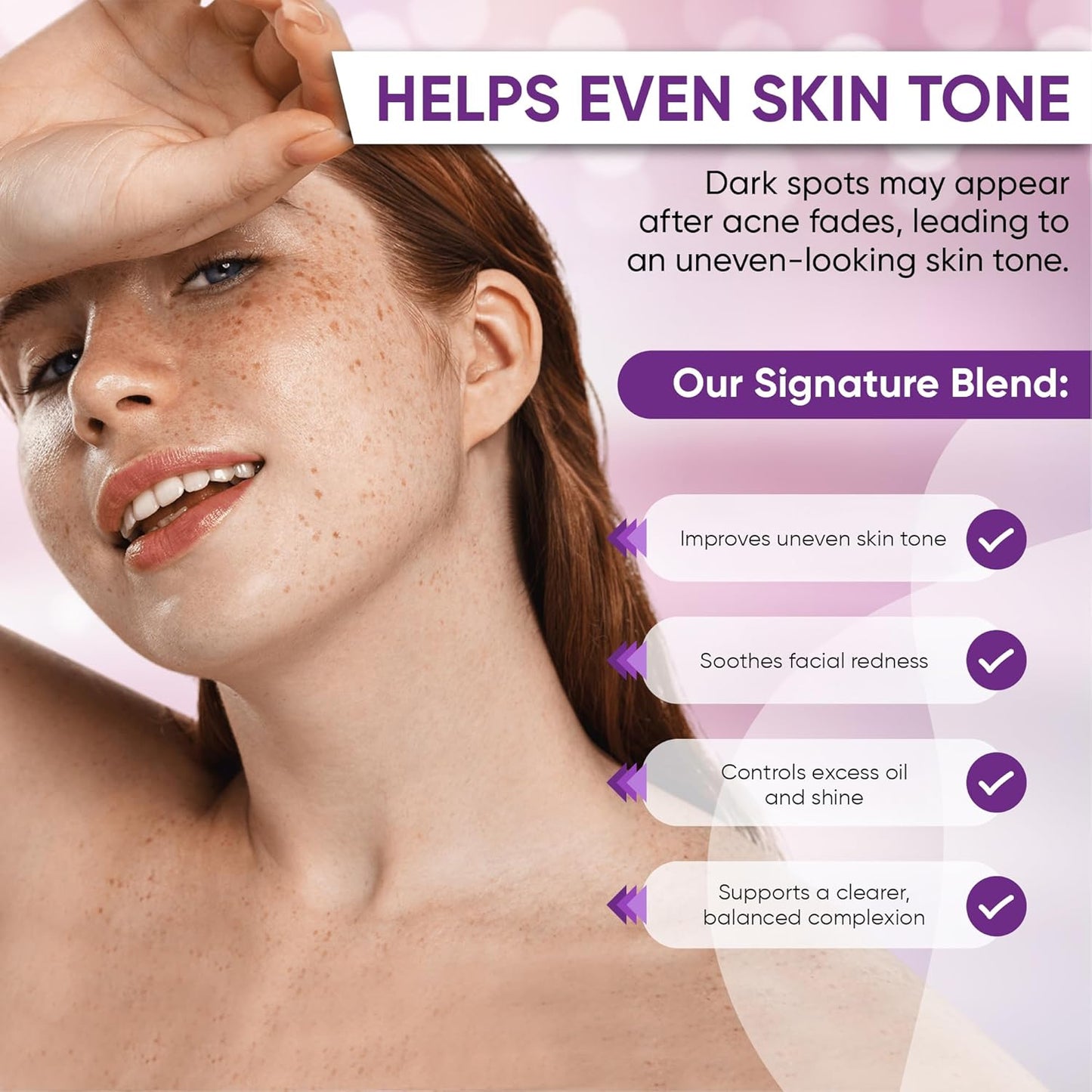 🔥🔥50% off microdermabrasion serum 💧 No redness on sensitive skin, no photorejuvenation