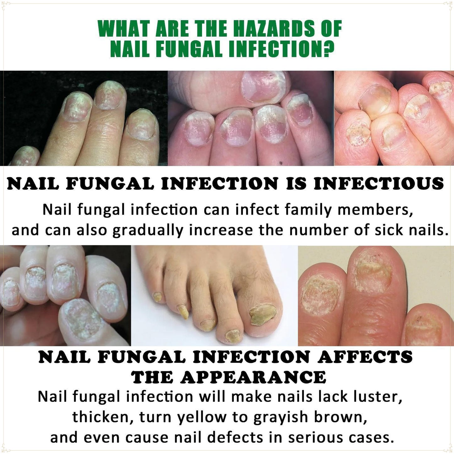 🌿Natural ginger essence! 🔥50% off on antibacterial and nail-nourishing products! 🔥