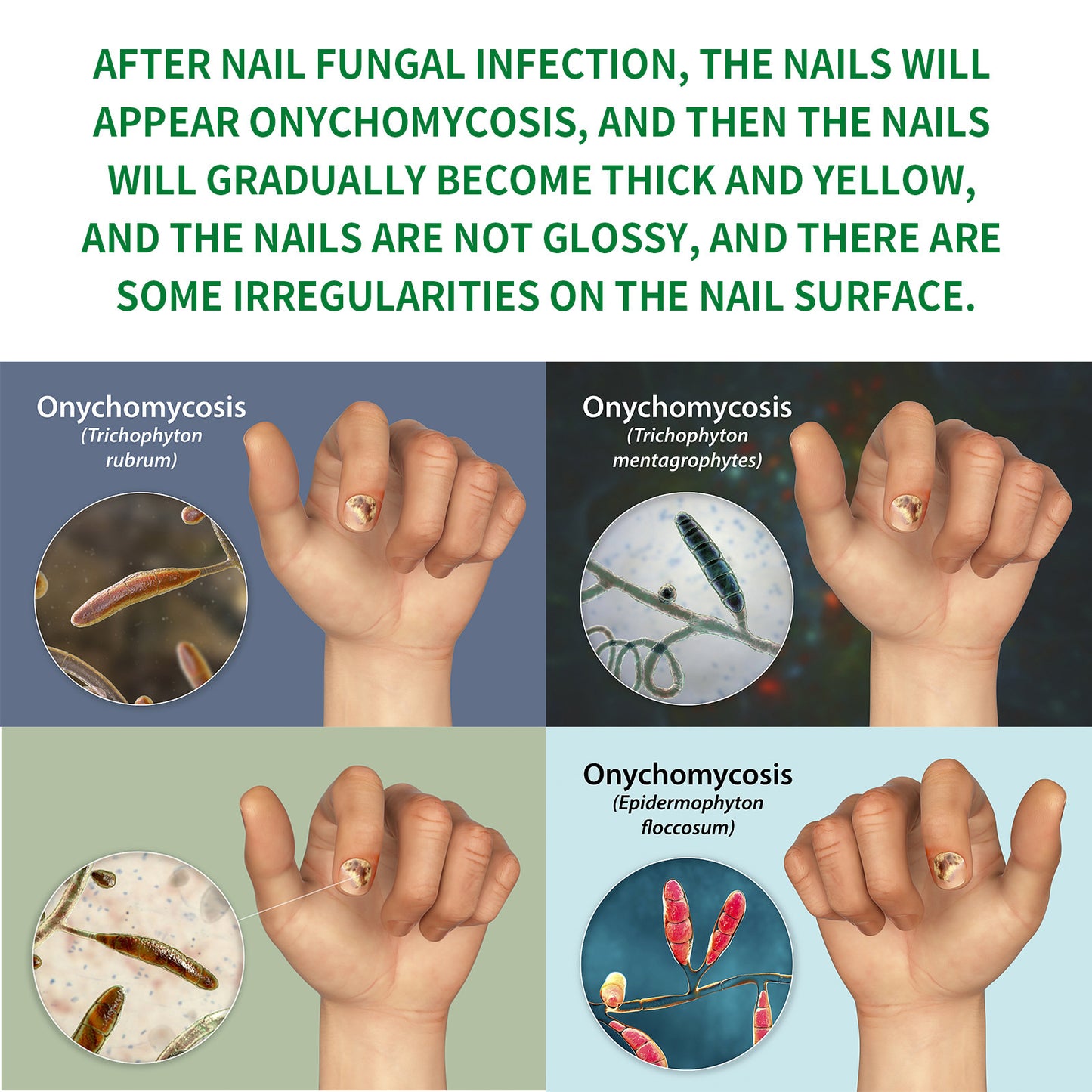 🌿Natural ginger essence! 🔥50% off on antibacterial and nail-nourishing products! 🔥