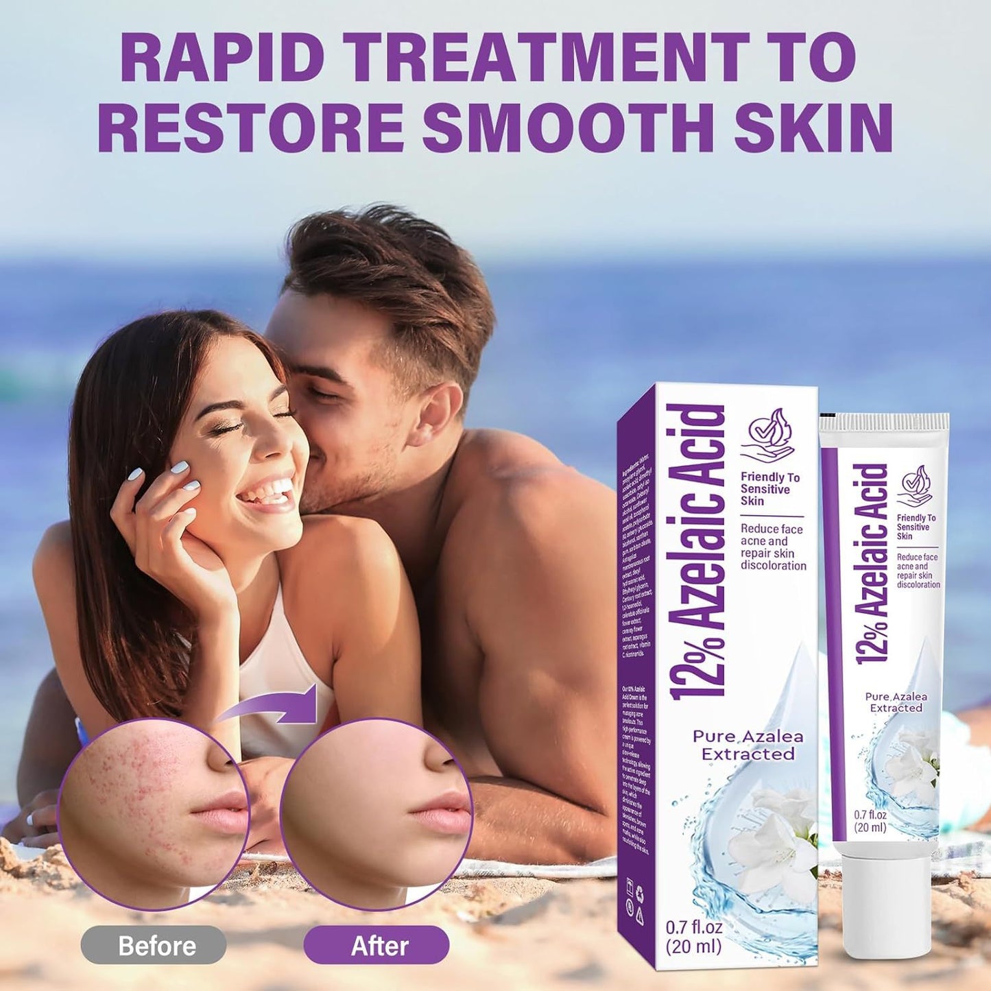 🔥🔥50% off microdermabrasion serum 💧 No redness on sensitive skin, no photorejuvenation