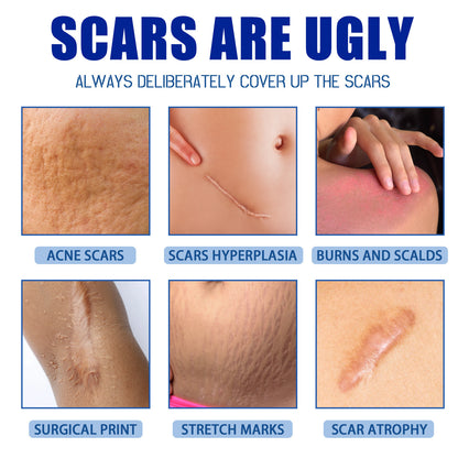Ugly scars?？？ 🔥 50% off repair cream to smooth out blemishes! 🔥