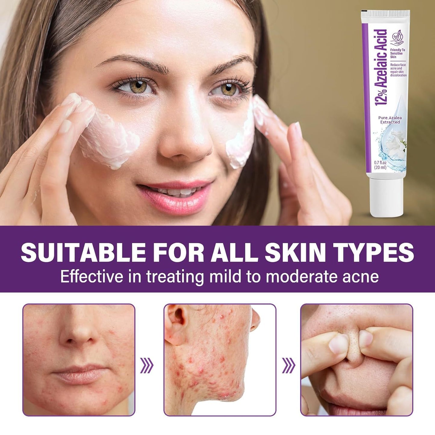 🔥🔥50% off microdermabrasion serum 💧 No redness on sensitive skin, no photorejuvenation