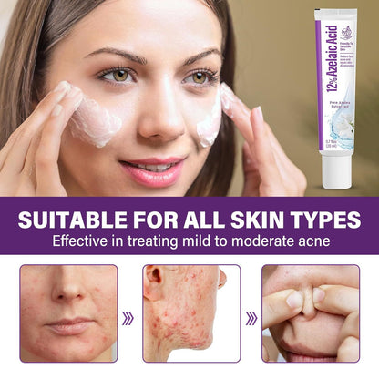 🔥🔥50% off microdermabrasion serum 💧 No redness on sensitive skin, no photorejuvenation
