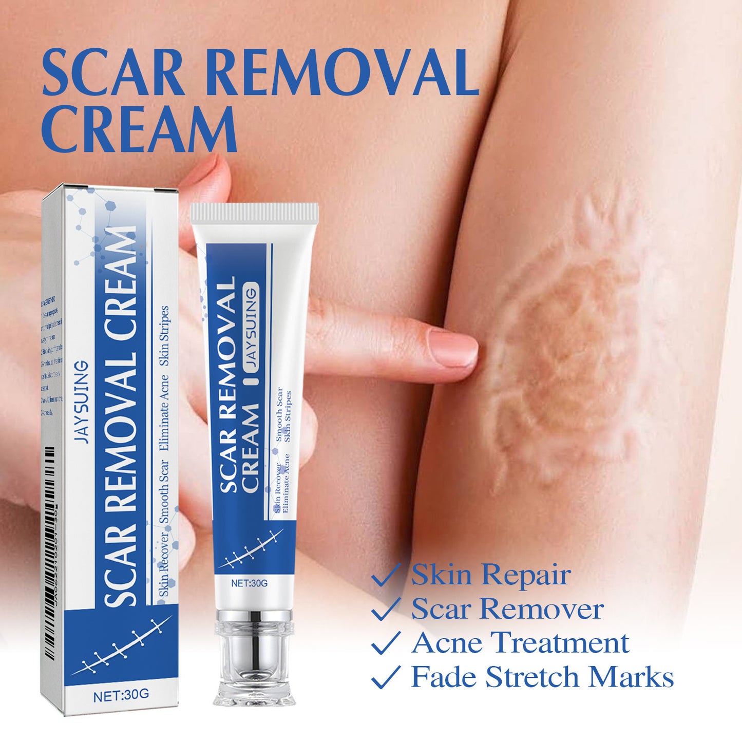 Ugly scars?？？ 🔥 50% off repair cream to smooth out blemishes! 🔥