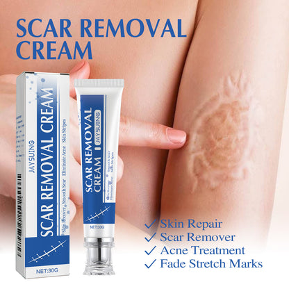 Ugly scars?？？ 🔥 50% off repair cream to smooth out blemishes! 🔥