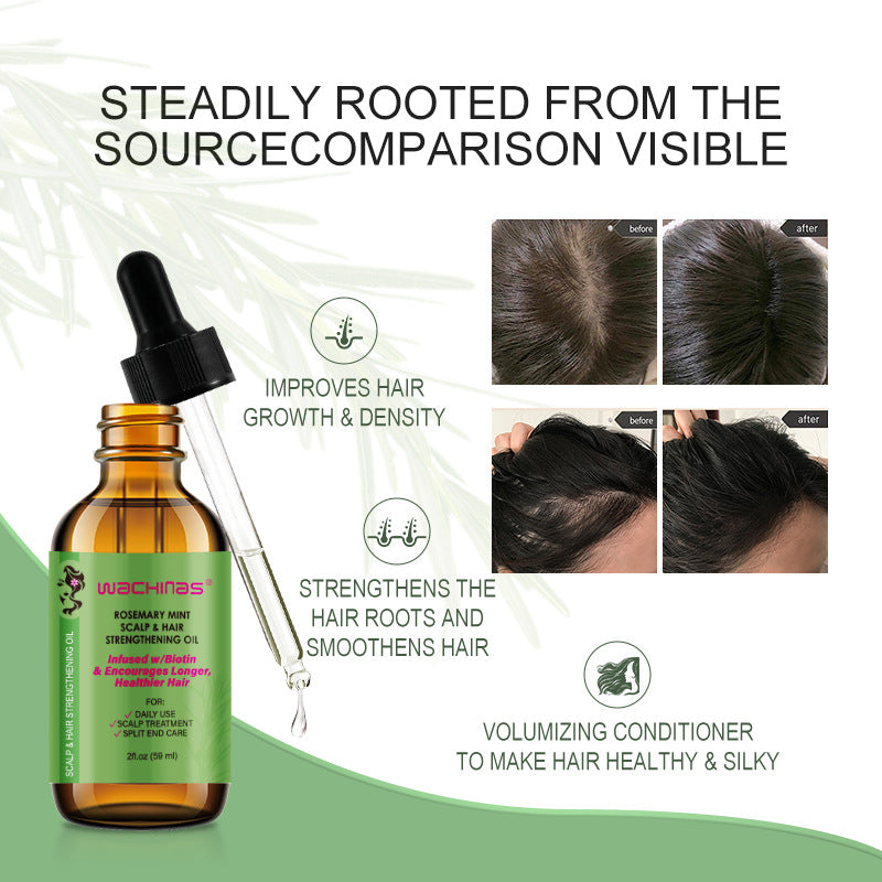 💇‍♀️Worried about baldness? 💧50% off Rosemary Hair Growth Oil to awaken your hair follicles! 🔥