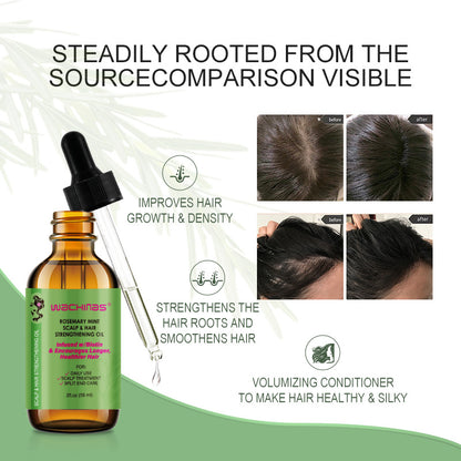 💇‍♀️Worried about baldness? 💧50% off Rosemary Hair Growth Oil to awaken your hair follicles! 🔥