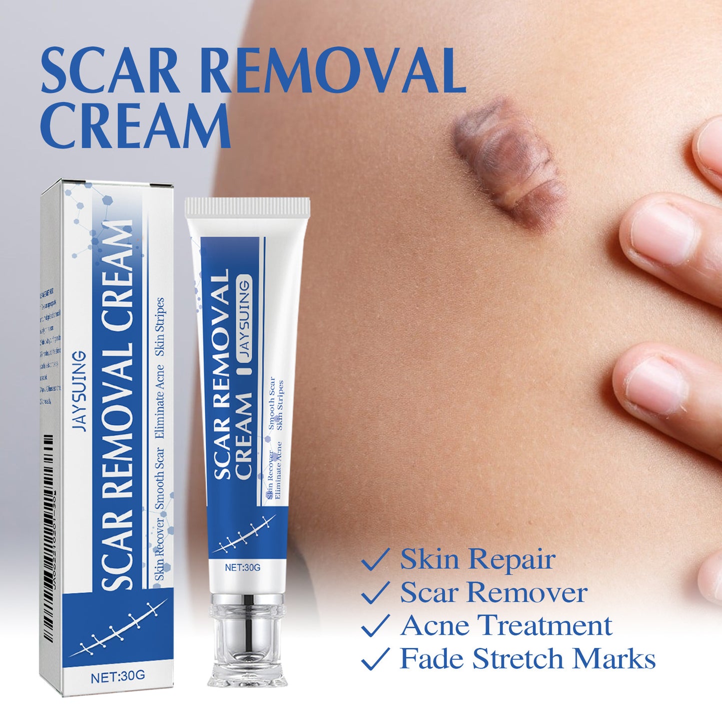 Ugly scars?？？ 🔥 50% off repair cream to smooth out blemishes! 🔥