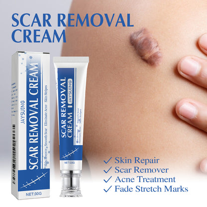 Ugly scars?？？ 🔥 50% off repair cream to smooth out blemishes! 🔥